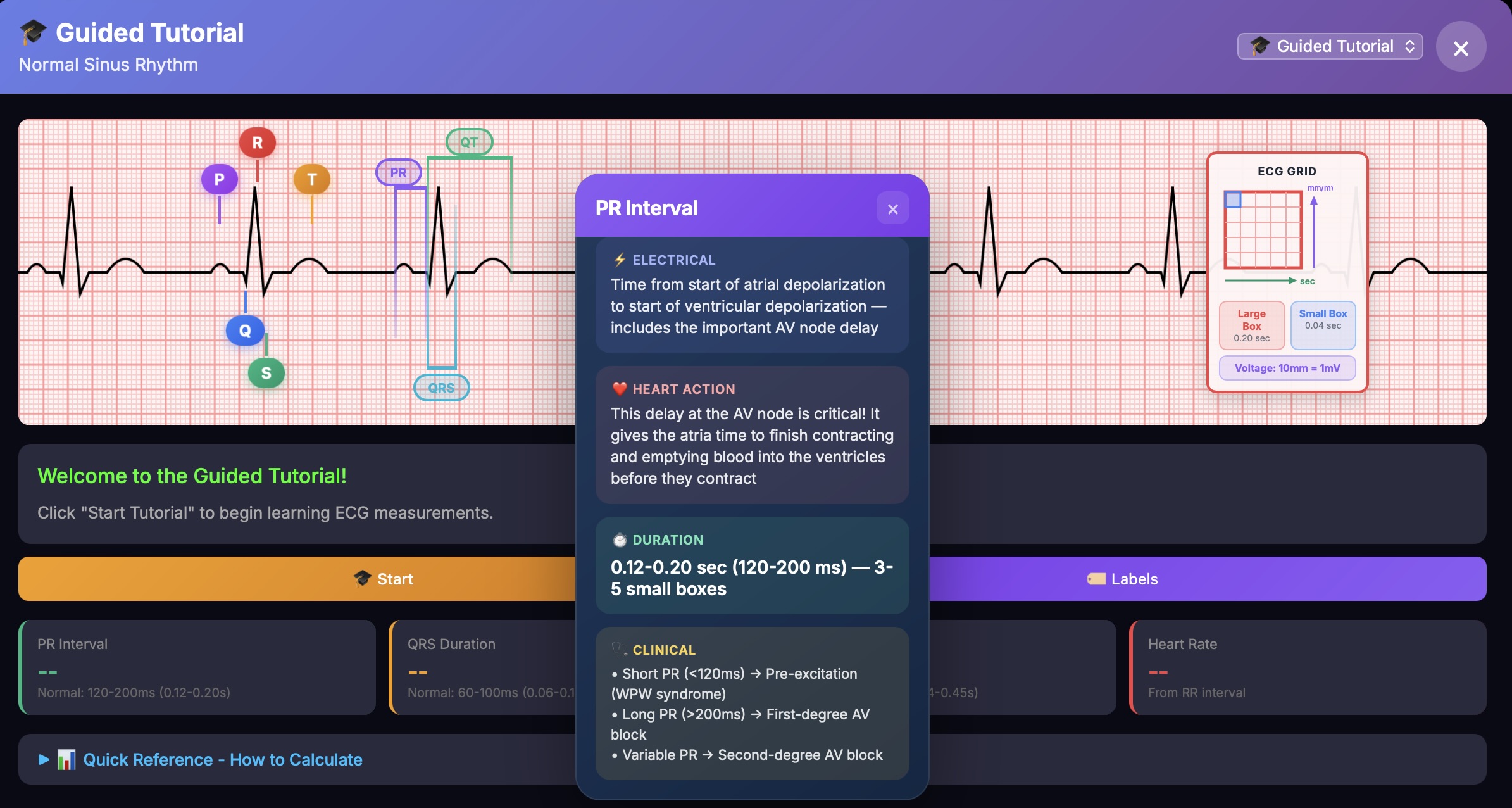 ECG Interval Details