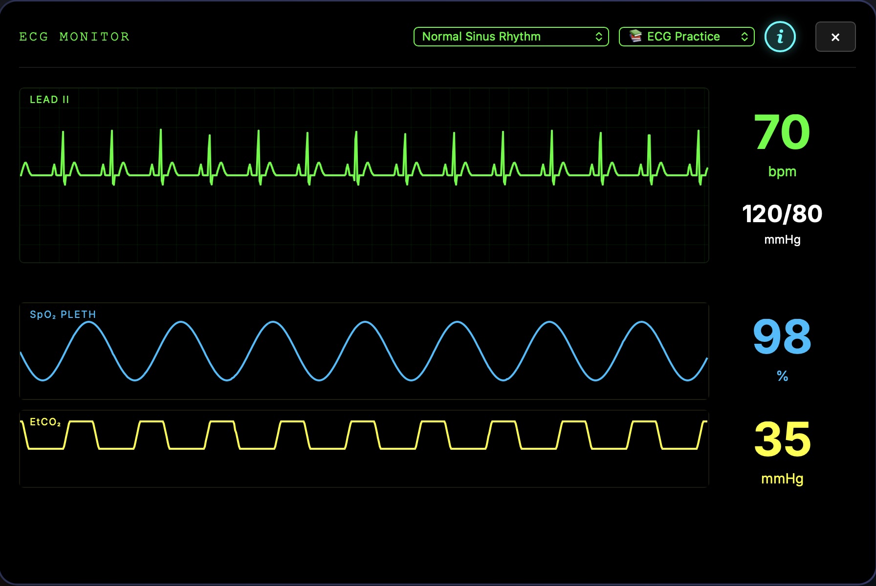 ECG Live Monitor